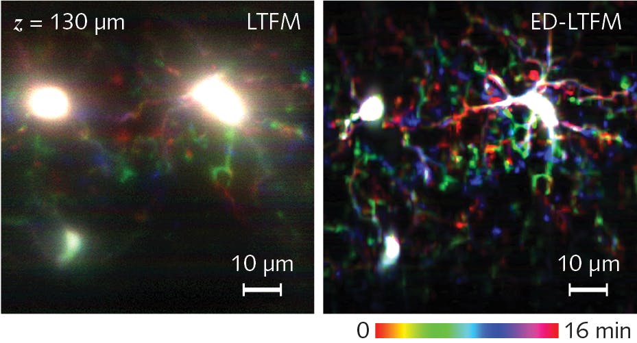 Deep imaging of biological dynamics in vivo with ED-LTFM. Temporal color-coded maximum-intensity-projection sequences of microglia cells along 30-&mu;m-thick image stack acquired with conventional LTFM (a) and ED-LTFM (b).