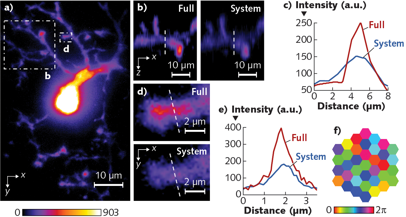 Controlling Scatter For High-speed, Deep-tissue Imaging | Laser Focus World