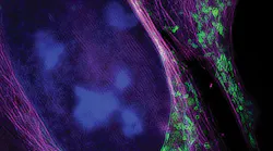 FIGURE 1. The one-step, approach produces images spatially resolved to 130 nm such as this, showing a living bone cancer cell stained with different fluorescent dyes to highlight the nucleus (blue), mitochondria (green) and cytoskeleton (magenta).