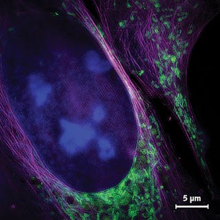 FIGURE 1. The one-step, approach produces images spatially resolved to 130 nm such as this, showing a living bone cancer cell stained with different fluorescent dyes to highlight the nucleus (blue), mitochondria (green) and cytoskeleton (magenta).