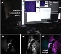 FIGURE 4. Instant superresolution image reconstruction enables high-speed live-cell imaging (a). Two SIM reconstructions—of the 488 nm fluorescence channel showing mitochondria stained with MitoTracker Green (b) and of the 647 nm channel depicting endoplasmic reticulum labeled with ER-Tracker Red (c)—show the components that are overlaid in (d). FIGURE 4. Instant superresolution image reconstruction enables high-speed live-cell imaging (a). Two SIM reconstructions—of the 488 nm fluorescence channel showing mitochondria stained with MitoTracker Green (b) and of the 647 nm channel depicting endoplasmic reticulum labeled with ER-Tracker Red (c)—show the components that are overlaid in (d).