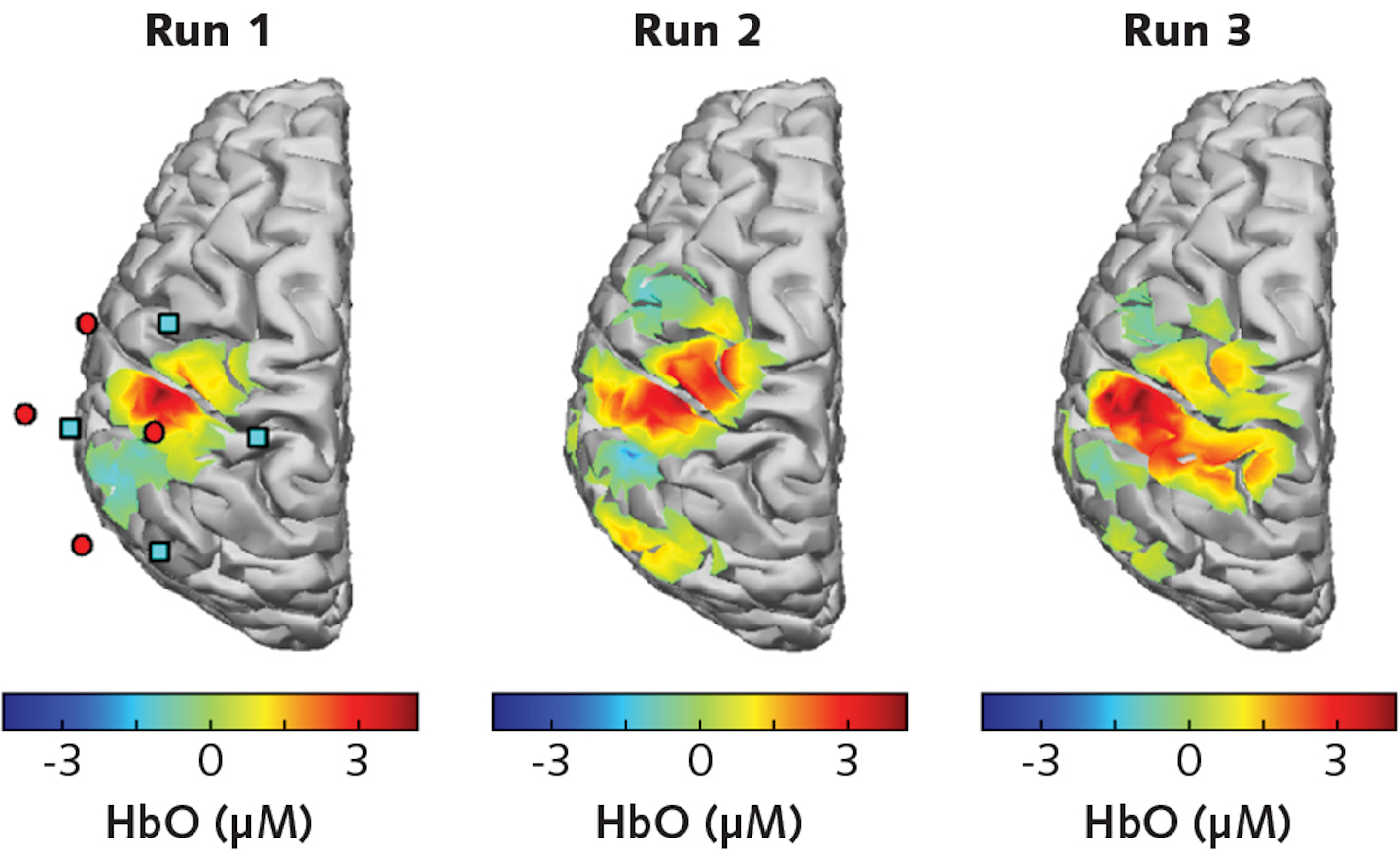 VCSEL-based functional near-IR spectroscopy images living brain ...