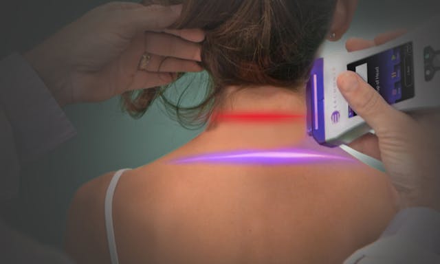 FIGURE 9. Erchonia announced its second FDA 510(k) approval of the year for use of its EVRL violet light laser for temporary relief of chronic musculoskeletal pain in the neck and shoulder. In a study designed to determine the EVRL&rsquo;s effectiveness, even subjects living with chronic pain for an average of 6+ years, experienced significant pain reduction with just a single treatment.
