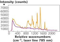 FIGURE 1. Raman spectra of lipid-rich fat tissue (orange) and protein-rich muscle tissue (purple); the broadband, autofluorescence background is clearly visible in both spectra, each of which was collected using a similar acquisition time. FIGURE 1. Raman spectra of lipid-rich fat tissue (orange) and protein-rich muscle tissue (purple); the broadband, autofluorescence background is clearly visible in both spectra, each of which was collected using a similar acquisition time.