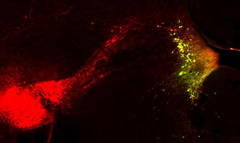 helps show what happens in brain cells during fearmemory formation Laser Focus World