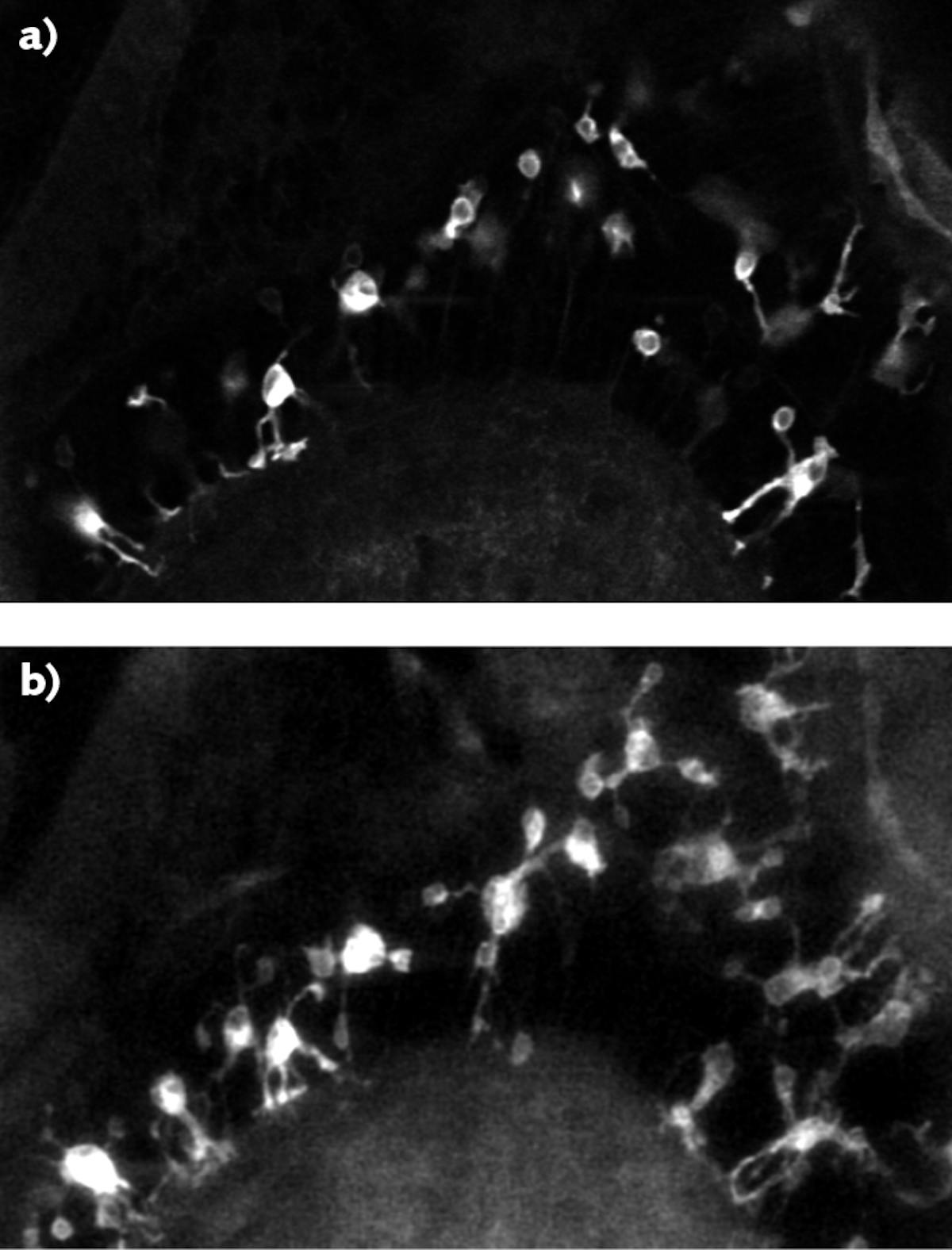 In vivo single-plane images of green fluorescent protein (GFP)-labeled microglial cells in zebrafish are dramatically improved when imaged with a multiphoton video-rate microscopy (VMS) system from Bliq Photonics without (a) and with (b) an axicon module that incorporates a Spark Laser Alcor fiber laser at 920 nm. For the same scanning time, the axicon module expands imaging depth of field and improves contrast. Scale bar is 20 &micro;m.