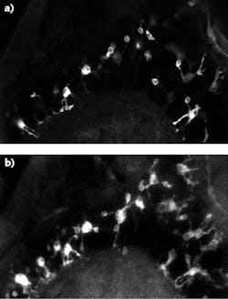 In vivo single-plane images of green fluorescent protein (GFP)-labeled microglial cells in zebrafish are dramatically improved when imaged with a multiphoton video-rate microscopy (VMS) system from Bliq Photonics without (a) and with (b) an axicon module that incorporates a Spark Laser Alcor fiber laser at 920 nm. For the same scanning time, the axicon module expands imaging depth of field and improves contrast. Scale bar is 20 µm. In vivo single-plane images of green fluorescent protein (GFP)-labeled microglial cells in zebrafish are dramatically improved when imaged with a multiphoton video-rate microscopy (VMS) system from Bliq Photonics without (a) and with (b) an axicon module that incorporates a Spark Laser Alcor fiber laser at 920 nm. For the same scanning time, the axicon module expands imaging depth of field and improves contrast. Scale bar is 20 µm.