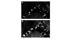 In vivo single-plane images of green fluorescent protein (GFP)-labeled microglial cells in zebrafish are dramatically improved when imaged with a multiphoton video-rate microscopy (VMS) system from Bliq Photonics without (a) and with (b) an axicon module that incorporates a Spark Laser Alcor fiber laser at 920 nm. For the same scanning time, the axicon module expands imaging depth of field and improves contrast. Scale bar is 20 µm.