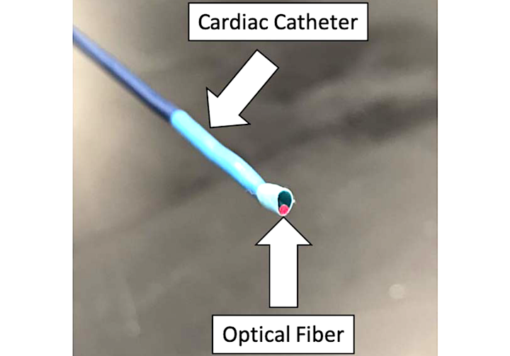 Photoacoustic Imaging Could Make Catheter-based Heart Procedures Safer 