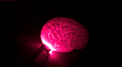 Laser Image