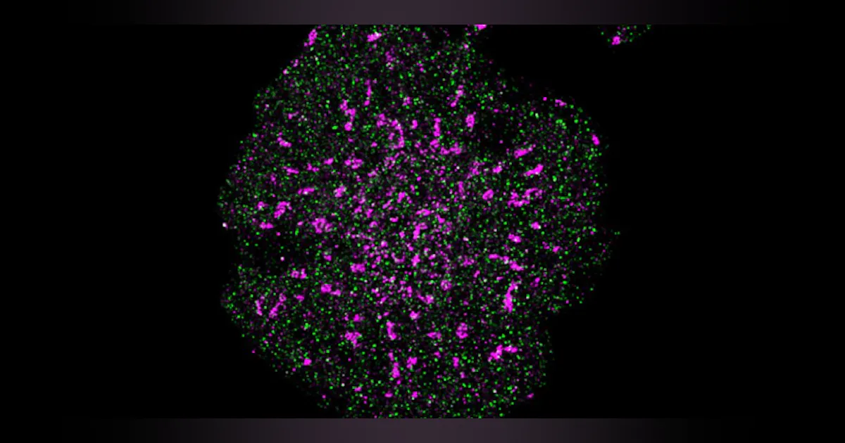Microscope Self Image Self-aligning microscope overcomes limits of superresolution microscopy ...