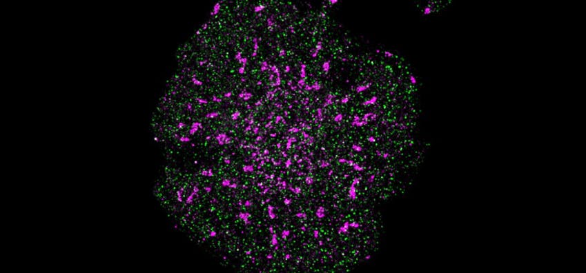 A T cell with precise localization of T cell receptors (pink) and CD45 phosphatase (green).