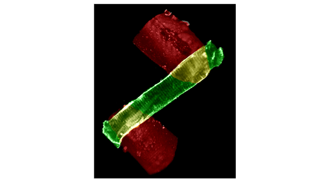 A heart cell, labeled with the membrane staining dye Di-8-ANEPPS (green), attached to MyoTak biological adhesive (red). Di-8 labels the sarcolemmal and t-tubule membranes of the heart cell, while the adhesive coats two glass micro-rods (not seen), which are used to attach and stretch single heart cells.