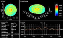 FIGURE 5. In the third run, zonal corrections are made. FIGURE 5. In the third run, zonal corrections are made.