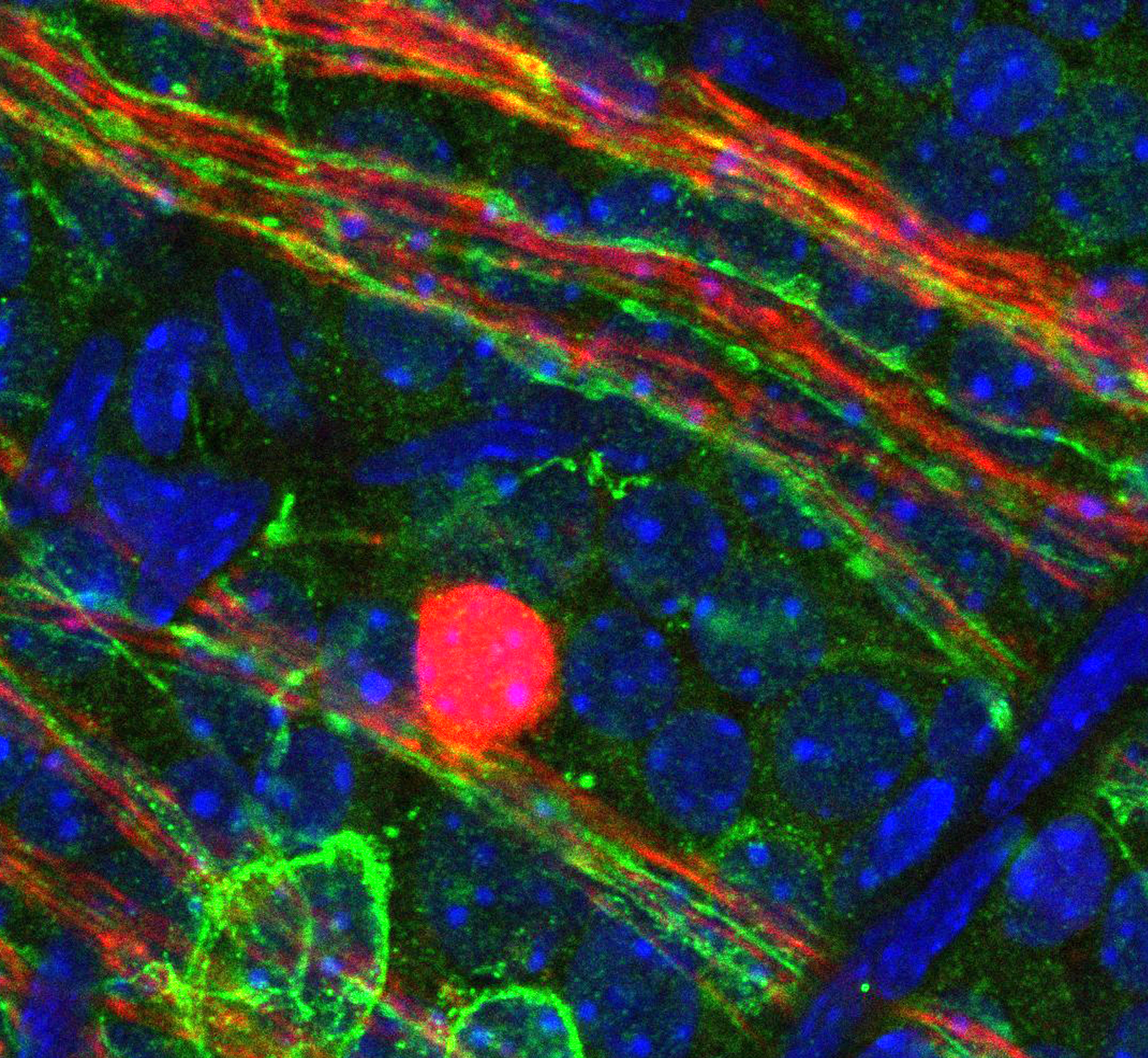 Light-sensitive opsin proteins, which researchers discovered in the retinal ganglia nerve fibers of the neonatal mouse eye, will help them investigate light-based therapies to prevent or treat eye diseases.