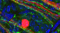 Light-sensitive opsin proteins, which researchers discovered in the retinal ganglia nerve fibers of the neonatal mouse eye, will help them investigate light-based therapies to prevent or treat eye diseases.
