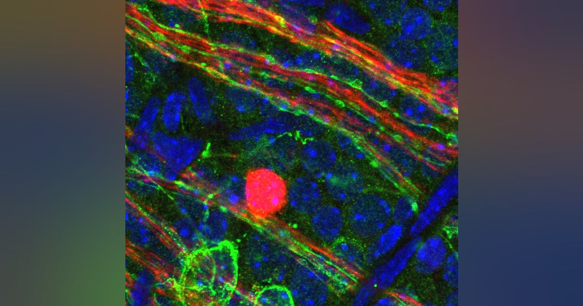 Ophthalmology/Oncology: New efforts indicate expanded application of ...