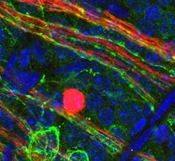 Light-sensitive opsin proteins, which researchers discovered in the retinal ganglia nerve fibers of the neonatal mouse eye, will help them investigate light-based therapies to prevent or treat eye diseases.