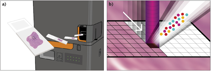 Tumor architecture insights advance cancer diagnosis and treatment