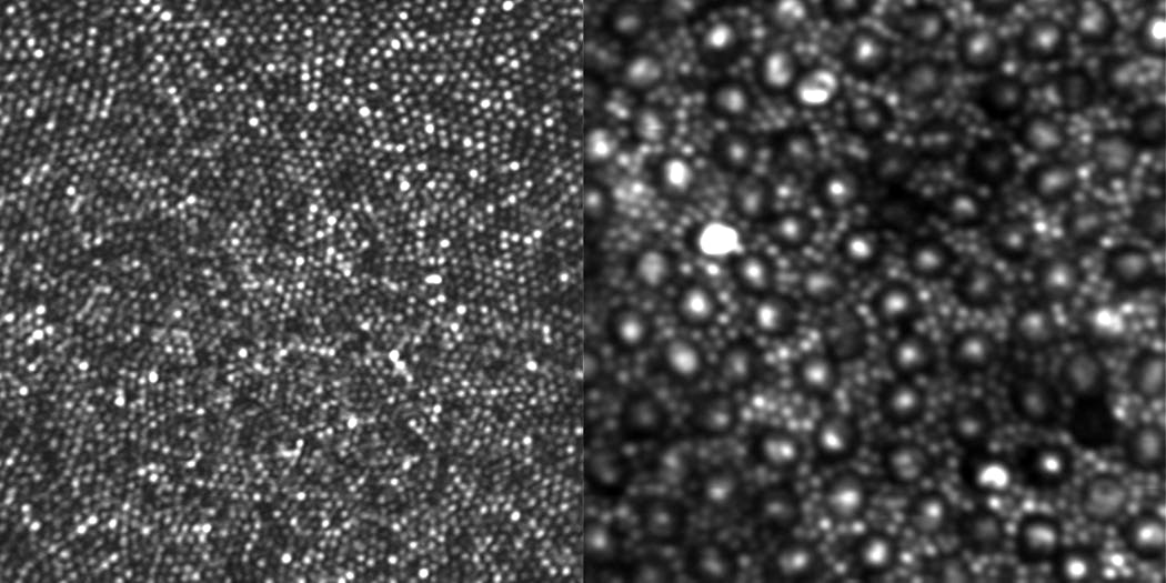 An afocal broadband adaptive-optics scanning ophthalmoscope images photoreceptors in a living human eye: cones in the fovea (left), and a combination of cones and rods in an area away from the center of the retina (right). In the right-hand image, the large bright dots with a dark ring around them are cones, and the surrounding (and far more abundant) smaller spots are rods.