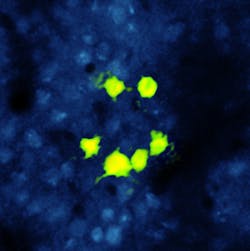 FIGURE 2. This bright image shows neuronal cells in a live mouse subject. Cell fluorescence is due to the calcium ion activity via the expression of GCaMP6s excited by the output of a tunable titanium sapphire laser (Coherent Chameleon Ultra II). The 'smiley face' pattern has been photoactivated via expression of a long-wavelength photoactivator (C1V1) using the multiwatt output of a ytterbium fiber laser (Coherent Fidelity) at 1055 nm. FIGURE 2. This bright image shows neuronal cells in a live mouse subject. Cell fluorescence is due to the calcium ion activity via the expression of GCaMP6s excited by the output of a tunable titanium sapphire laser (Coherent Chameleon Ultra II). The 'smiley face' pattern has been photoactivated via expression of a long-wavelength photoactivator (C1V1) using the multiwatt output of a ytterbium fiber laser (Coherent Fidelity) at 1055 nm.