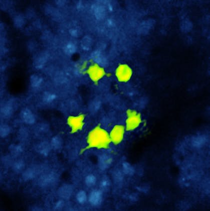 FIGURE 2. This bright image shows neuronal cells in a live mouse subject. Cell fluorescence is due to the calcium ion activity via the expression of GCaMP6s excited by the output of a tunable titanium sapphire laser (Coherent Chameleon Ultra II). The &apos;smiley face&apos; pattern has been photoactivated via expression of a long-wavelength photoactivator (C1V1) using the multiwatt output of a ytterbium fiber laser (Coherent Fidelity) at 1055 nm.