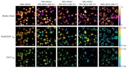 FIGURE 2. During the Saturday evening Hot Topics session at BiOS, Melissa Skala of Vanderbilt University will speak on imaging cellular heterogeneity, as demonstrated in this image from Biomedical Optics Express, 6, 2, 559–573 (2015); doi:10.1364/BOE.6.000559. FIGURE 2. During the Saturday evening Hot Topics session at BiOS, Melissa Skala of Vanderbilt University will speak on imaging cellular heterogeneity, as demonstrated in this image from Biomedical Optics Express, 6, 2, 559–573 (2015); doi:10.1364/BOE.6.000559.