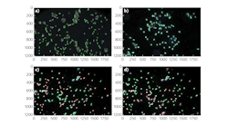 Spectral angle mapping (SAM) allowed differentiation of cells imaged using hyperspectral dark-field microscopy. Cells below the threshold spectral angle are marked as positive using a green outline; cells above the threshold are marked as negative with a red outline. Isolate cell detection shows positive E. coli 157:H7 (a) and Listeria monocytogenes (b). A slide with both pathogens depict E. coli (c) at positive (48) and negative (65), and Listeria monocytogenes (d) at positive (66) and negative (47).