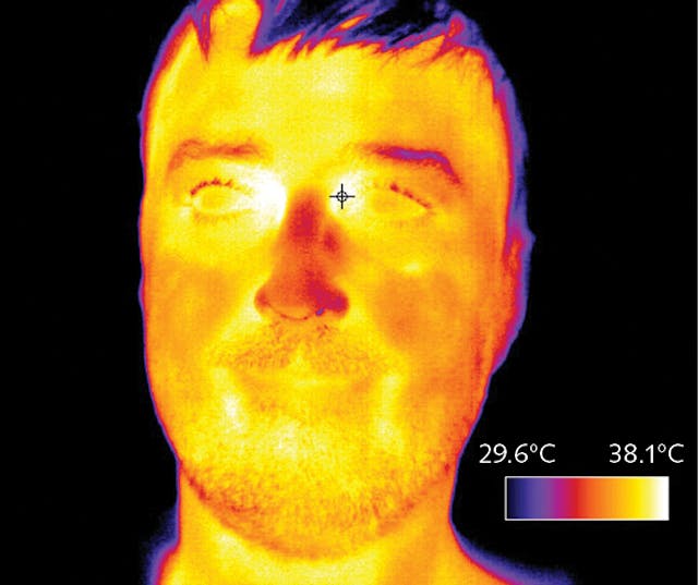 FIGURE 5. Although cameras cannot diagnose disease, they can provide a temperature reading of elevated skin temperature, which might indicate fever&mdash;a symptom of COVID-19. With the current pandemic, companies are considering the best way to get people back to work and are establishing new procedures to screen employees who may unknowingly have symptoms and could spread COVID-19. Public buildings including hospitals, malls, performance venues, and government buildings are also determining the best method for screening visitors. Eventually, the &ldquo;new normal&rdquo; may require fever screening for most large gatherings, including sporting events, concerts, movie theaters, and other places where people will be in close contact. With thermal imaging cameras, an initial scan can be done automatically as individuals enter a building. When an individual shows signs of elevated skin temperature, a medical professional can then follow up with a handheld thermometer. Here, a Calibir LWIR camera by Teledyne DALSA produces a temperature map of a feverish individual.