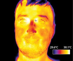 FIGURE 5. Although cameras cannot diagnose disease, they can provide a temperature reading of elevated skin temperature, which might indicate fever—a symptom of COVID-19. With the current pandemic, companies are considering the best way to get people back to work and are establishing new procedures to screen employees who may unknowingly have symptoms and could spread COVID-19. Public buildings including hospitals, malls, performance venues, and government buildings are also determining the best method for screening visitors. Eventually, the “new normal” may require fever screening for most large gatherings, including sporting events, concerts, movie theaters, and other places where people will be in close contact. With thermal imaging cameras, an initial scan can be done automatically as individuals enter a building. When an individual shows signs of elevated skin temperature, a medical professional can then follow up with a handheld thermometer. Here, a Calibir LWIR camera by Teledyne DALSA produces a temperature map of a feverish individual. FIGURE 5. Although cameras cannot diagnose disease, they can provide a temperature reading of elevated skin temperature, which might indicate fever—a symptom of COVID-19. With the current pandemic, companies are considering the best way to get people back to work and are establishing new procedures to screen employees who may unknowingly have symptoms and could spread COVID-19. Public buildings including hospitals, malls, performance venues, and government buildings are also determining the best method for screening visitors. Eventually, the “new normal” may require fever screening for most large gatherings, including sporting events, concerts, movie theaters, and other places where people will be in close contact. With thermal imaging cameras, an initial scan can be done automatically as individuals enter a building. When an individual shows signs of elevated skin temperature, a medical professional can then follow up with a handheld thermometer. Here, a Calibir LWIR camera by Teledyne DALSA produces a temperature map of a feverish individual.