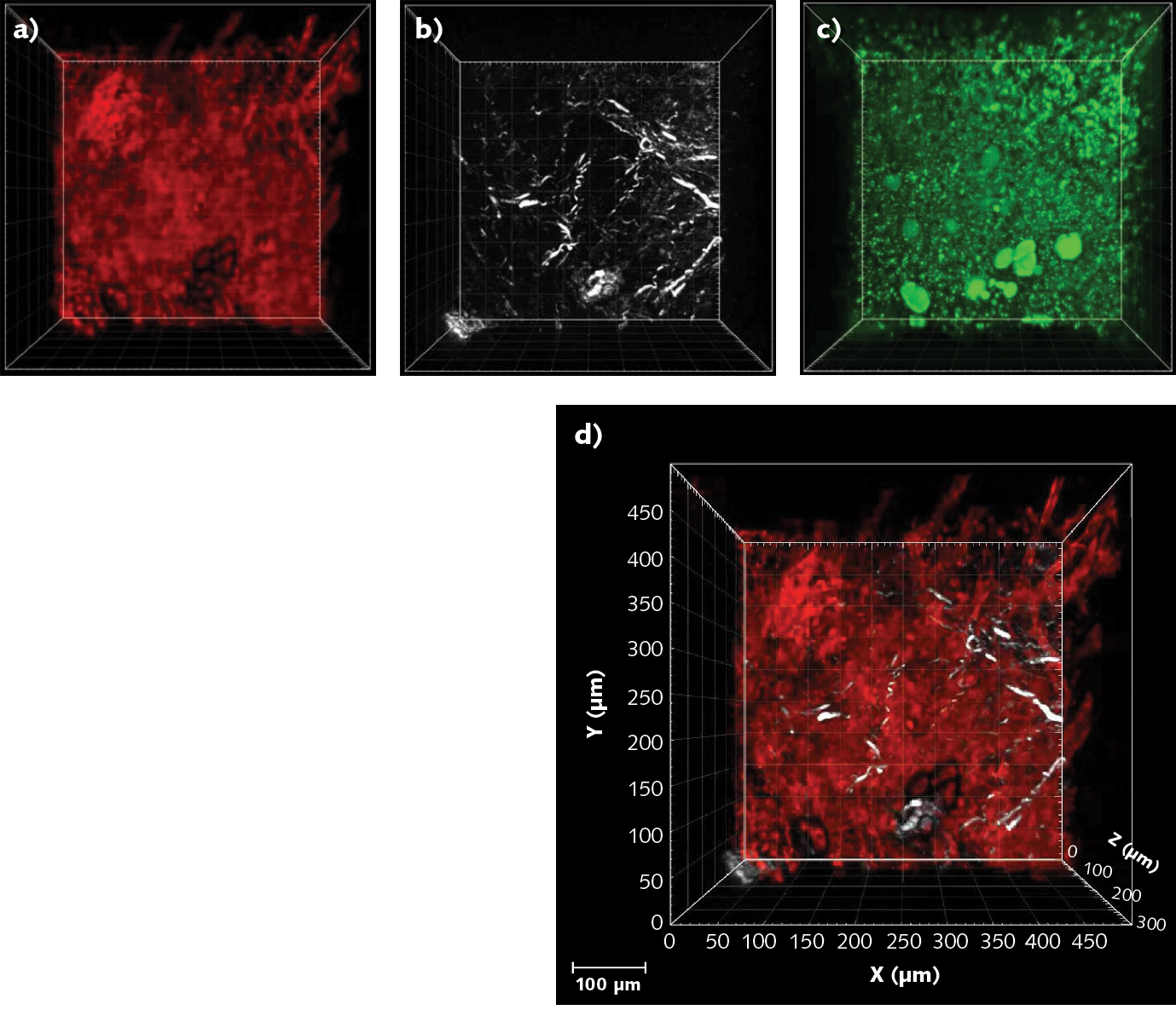 FIGURE 3. Murine lymph-node z stack images, where z = 300 &mu;m, are obtained using a Coherent Monaco Opera-F combination tuned to a wavelength of 1630 nm and a LaVision Trim Scope microscope. The red image is due to 3P excitation of tdTomato (a fluorescent protein) detected at 595 (&PlusMinus;20) nm (a), the white image is due to SHG signals from collagen fibers detected at 810 (&PlusMinus;45) nm (b), and the green signal originates from THG of lipid bilayers, lipids, or other anisotropic structures and was detected at 525 (&PlusMinus;25) nm (c). The composite image combines the tdTomato and SHG signals (d).