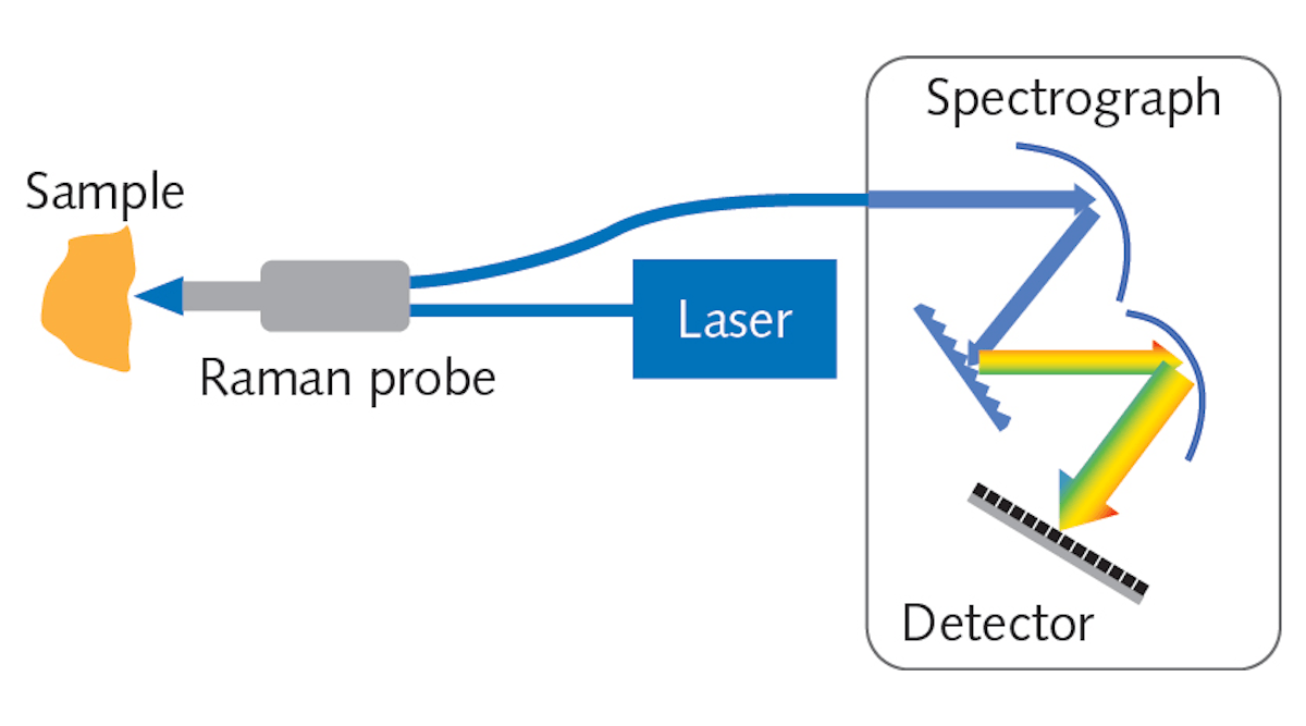 FIGURE 1. The key components of a Raman spectroscopy system are the laser, detector, spectrograph, and probe.