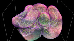 Fluorescence Microscopy