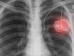 Small Thumbnail Image 5f0f44a2576d4 Small Thumbnail Image 5f0f44a2576d4