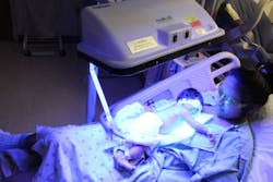 FIGURE 2. Wrapping a baby with jaundice in a fiber-optic &apos;biliblanket&apos; illuminates its skin with blue light, helping the child&apos;s body break down harmful bilirubin.
