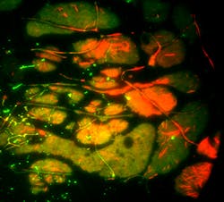 FIGURE 3. These xenopus laevis embryos, transfected with GFP-cadherin and RFP-actin, were imaged in dual-color TIRF using Semrock's LF405/488/561/635-B λ/2 flatness super-resolution microscopy cube. FIGURE 3. These xenopus laevis embryos, transfected with GFP-cadherin and RFP-actin, were imaged in dual-color TIRF using Semrock's LF405/488/561/635-B λ/2 flatness super-resolution microscopy cube.