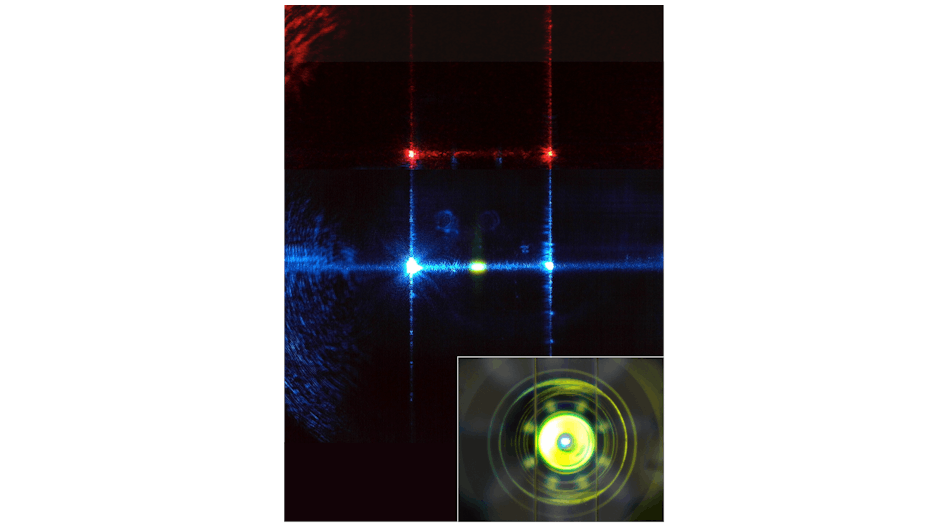 FIGURE 1. This composite microscope image shows a 488 nm laser beam (center) and a 640 nm laser beam (top) focused from the side into a flowcell channel (vertical channel walls visible because of scattered light). A flowing sample of 3 &mu;m fluorescent beads lights up in the 488 nm beam (bright oval in the center). The fluorescence light collection path (inset; concentric circles) is aligned behind the flowcell under LED illumination.