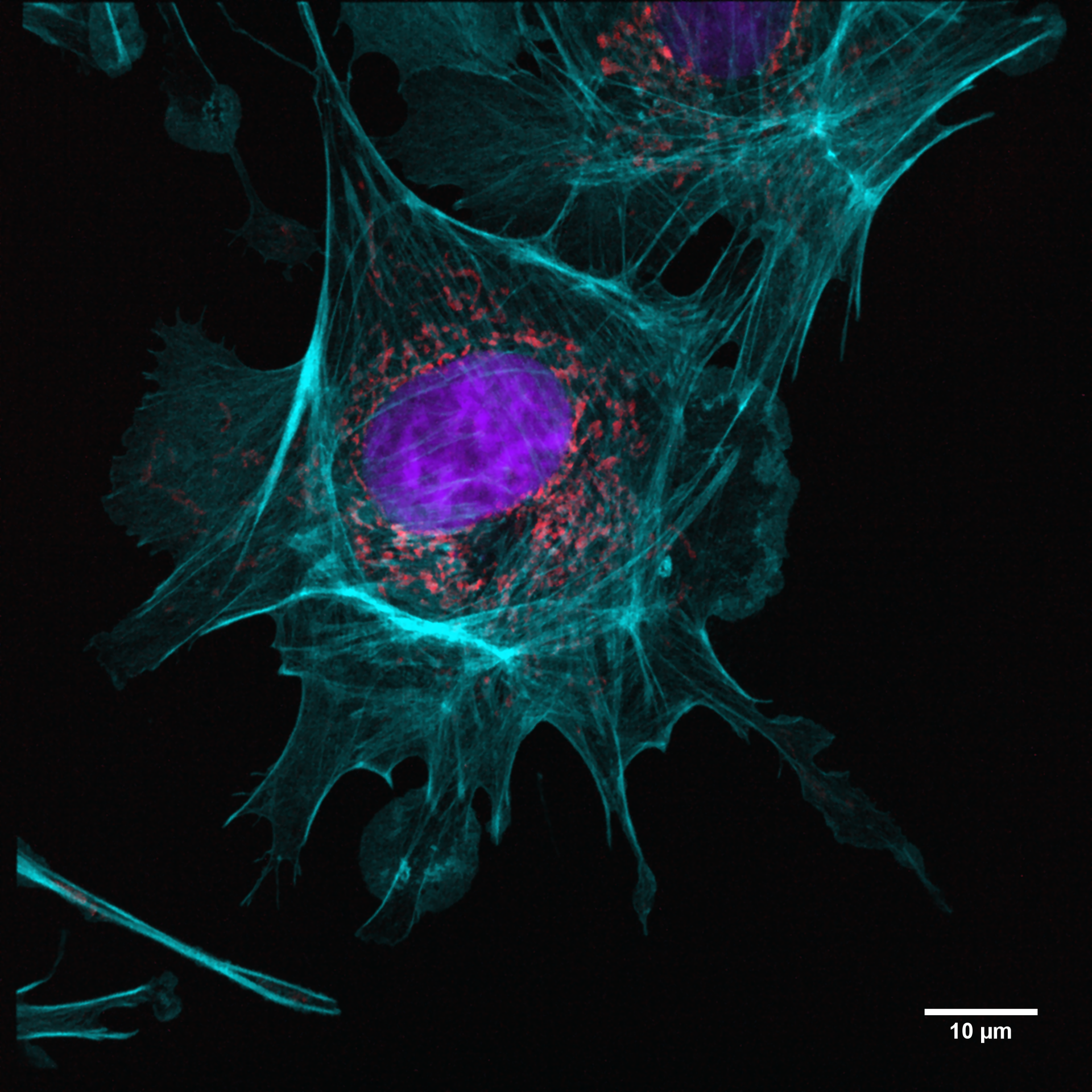 An example of an image taken in a single-molecule localization microscopy (SMLM) setup from the Department of Biotechnology & Biophysics at Julius-Maximilian-University of Würzburg; the three-color image is a BPAE cell with mitotracker (red), actin (cyan), and nucleus (DAPI; blue) staining (recording time: 4 s per channel, with 2048 &times; 2048 pixel image detail).