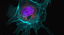 An example of an image taken in a single-molecule localization microscopy (SMLM) setup from the Department of Biotechnology & Biophysics at Julius-Maximilian-University of Würzburg; the three-color image is a BPAE cell with mitotracker (red), actin (cyan), and nucleus (DAPI; blue) staining (recording time: 4 s per channel, with 2048 × 2048 pixel image detail).