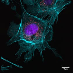 An example of an image taken in a single-molecule localization microscopy (SMLM) setup from the Department of Biotechnology & Biophysics at Julius-Maximilian-University of Würzburg; the three-color image is a BPAE cell with mitotracker (red), actin (cyan), and nucleus (DAPI; blue) staining (recording time: 4 s per channel, with 2048 × 2048 pixel image detail). An example of an image taken in a single-molecule localization microscopy (SMLM) setup from the Department of Biotechnology & Biophysics at Julius-Maximilian-University of Würzburg; the three-color image is a BPAE cell with mitotracker (red), actin (cyan), and nucleus (DAPI; blue) staining (recording time: 4 s per channel, with 2048 × 2048 pixel image detail).