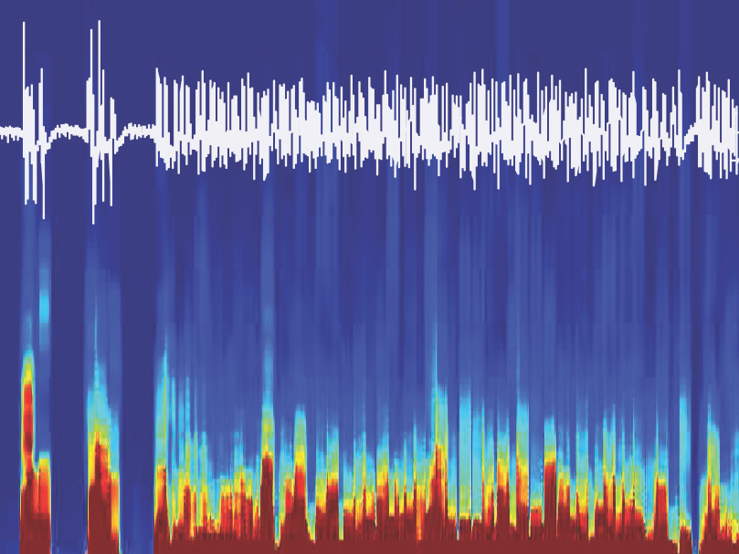 EEG recordings from a mouse brain controlled with optogenetics show emergence from anesthesia.