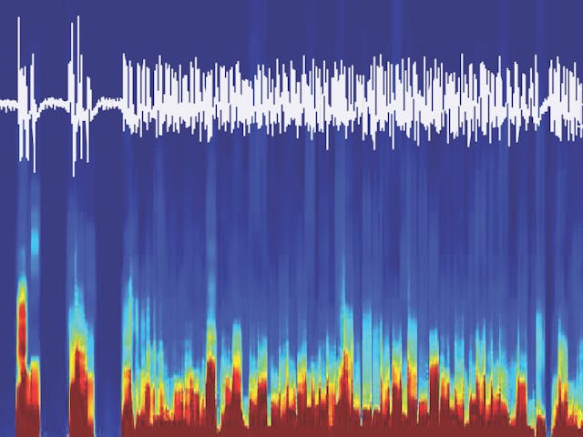 EEG recordings from a mouse brain controlled with optogenetics show emergence from anesthesia.