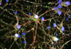 Imaging studies found C4 (green) at synapses (red and white) of cultured human neurons (blue). Imaging studies found C4 (green) at synapses (red and white) of cultured human neurons (blue).
