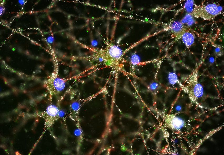 Imaging studies found C4 (green) at synapses (red and white) of cultured human neurons (blue).