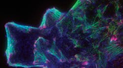 FIGURE 1. Three-color TIRF/evanescent wave imaging shows the basal cytoskeleton in pulmonary airway endothelium grown in vitro, showing actin (blue), myosin (green), and paxillin (red). FIGURE 1. Three-color TIRF/evanescent wave imaging shows the basal cytoskeleton in pulmonary airway endothelium grown in vitro, showing actin (blue), myosin (green), and paxillin (red).