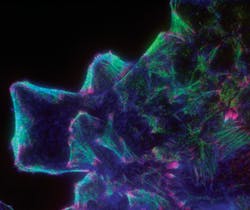 FIGURE 1. Three-color TIRF/evanescent wave imaging shows the basal cytoskeleton in pulmonary airway endothelium grown in vitro, showing actin (blue), myosin (green), and paxillin (red). FIGURE 1. Three-color TIRF/evanescent wave imaging shows the basal cytoskeleton in pulmonary airway endothelium grown in vitro, showing actin (blue), myosin (green), and paxillin (red).
