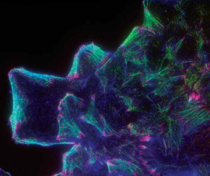 FIGURE 1. Three-color TIRF/evanescent wave imaging shows the basal cytoskeleton in pulmonary airway endothelium grown in vitro, showing actin (blue), myosin (green), and paxillin (red).