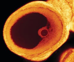 FIGURE 3. This laser scanning confocal photomicrograph (100X magnification) shows a rat preovulatory follicle, including an oocyte surrounded by granulosa cells within the antral cavity. An individual section of an ovarian follicle is stained with Yo-Pro-1 (Molecular Probes). Whole ovary tissue was fixed in paraformaldehyde, dehydrated in 100% MEOH, and cleared in BABB. The focal plane in these pictures was optically sliced at the point of the oocyte's nucleolus. Images were taken with a 10X (NA 0.3) objective using a Chroma Triple Dichroic filter and a Barrier filter 532/22 on a Leica confocal microscope. FIGURE 3. This laser scanning confocal photomicrograph (100X magnification) shows a rat preovulatory follicle, including an oocyte surrounded by granulosa cells within the antral cavity. An individual section of an ovarian follicle is stained with Yo-Pro-1 (Molecular Probes). Whole ovary tissue was fixed in paraformaldehyde, dehydrated in 100% MEOH, and cleared in BABB. The focal plane in these pictures was optically sliced at the point of the oocyte's nucleolus. Images were taken with a 10X (NA 0.3) objective using a Chroma Triple Dichroic filter and a Barrier filter 532/22 on a Leica confocal microscope.