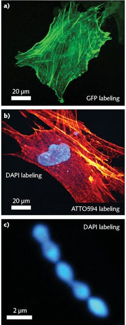 FIGURE 3. Two-photon microscopy images were taken using a FemtoFiber ultra 920 ultrafast fiber laser for fluorescence excitation: image of a human stem cell expressing green fluorescent protein (GFP) attached to its actin network (a); human stem cell with ATTO594 protein labeling of the actin network and DAPI fluorescent DNA labeling of the cell nucleus (b); and S. pneumoniae bacteria labeled with DAPI (c).