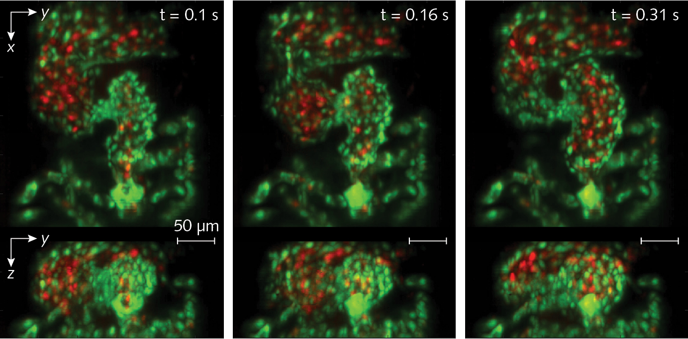 FIGURE 4. This triptych, drawn from video showing a zebrafish heart beating in real time, was captured at 100 vps. Top panels show z-projection and bottom panels show x-projection. The heart&rsquo;s ventricle begins compressed, with the outflow valve open, and then fills from the atrium in successive images. Endothelial cells of the heart wall are labeled with EGFP (green) while red blood cells are labelled with DsRed (red). Both fluorophores were excited with 488 nm laser light (0.6 mW at the sample). For full details, including video, see V. Voleti et al. [2]